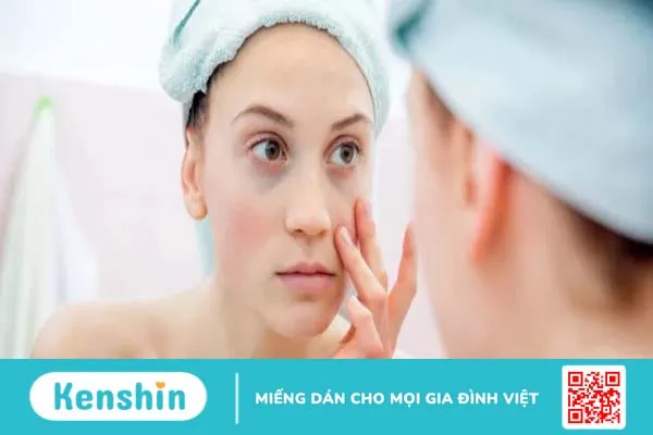 Cách xác định loại da giúp bạn chăm sóc da mặt thật “chuẩn”