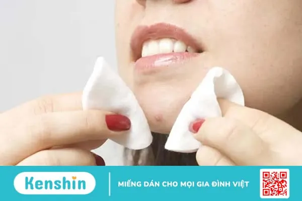 Cẩm nang hướng dẫn tự nặn mụn an toàn