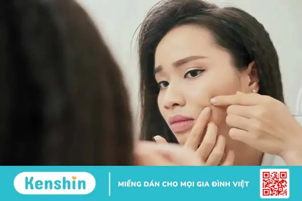 Cẩm nang hướng dẫn tự nặn mụn an toàn