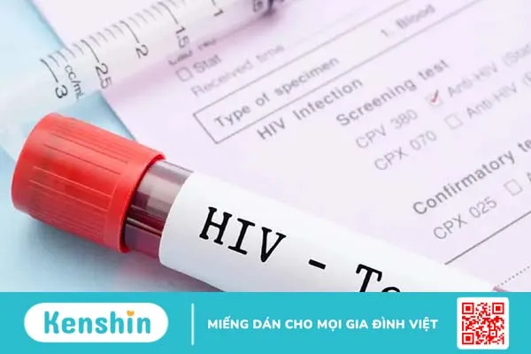 Cẩm nang những điều bạn cần biết về tình trạng trẻ bị nhiễm HIV