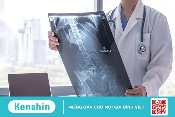 Cảnh báo 6 dấu hiệu ung thư thực quản