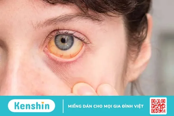 Cảnh báo 9 dấu hiệu ung thư gan giai đoạn đầu