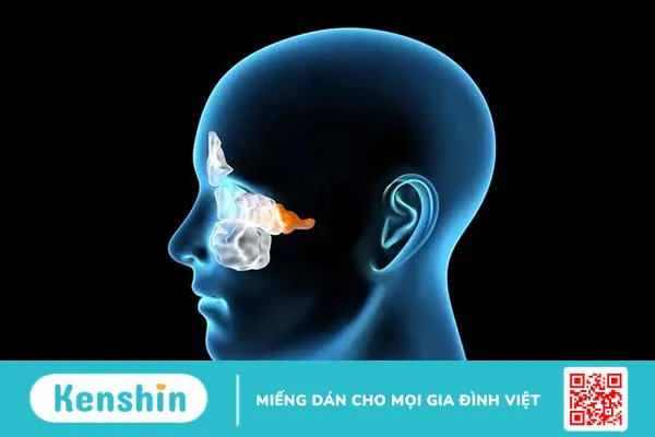 Cảnh giác với các triệu chứng viêm xoang đặc trưng để điều trị kịp thời