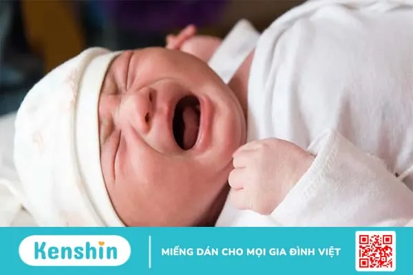 Cảnh giác với căn bệnh rò hậu môn ở trẻ sơ sinh