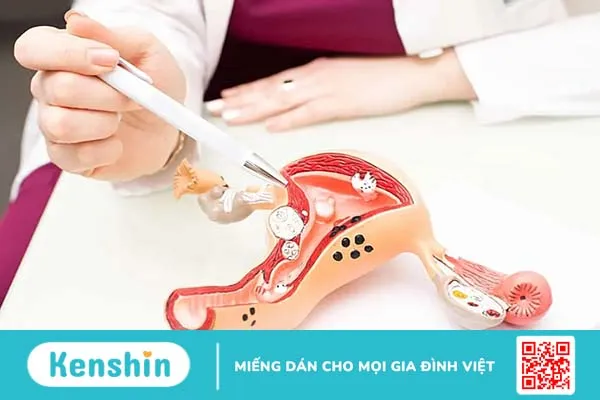 Cắt bỏ tử cung qua đường mở bụng