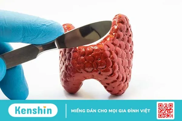 Cắt toàn bộ tuyến giáp có gây ảnh hưởng gì nguy hiểm đến sức khỏe?