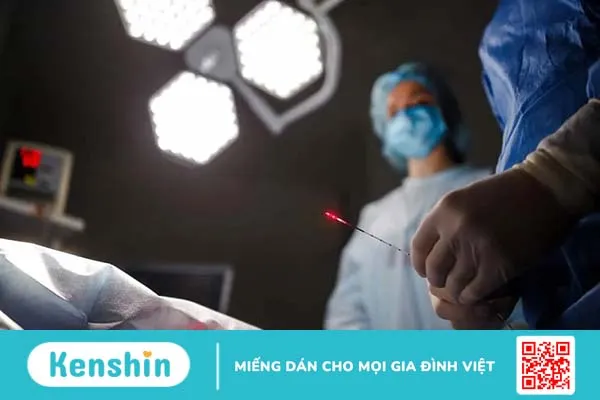 Cắt trĩ bằng laser bao nhiêu tiền? Có đau không? Ai nên thực hiện?