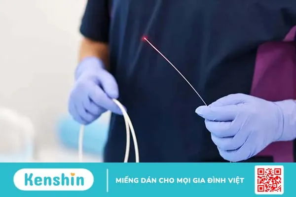 Cắt trĩ bằng laser là gì? Ưu, nhược điểm và quy trình cắt trĩ bằng laser