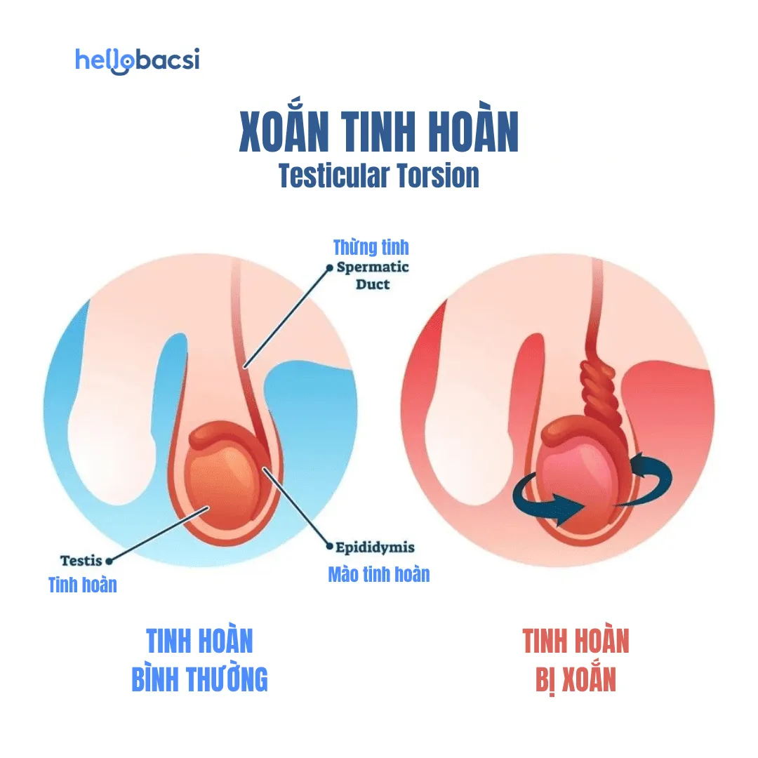 Cấu tạo tinh hoàn: Tìm hiểu kích thước, chức năng và bệnh lý