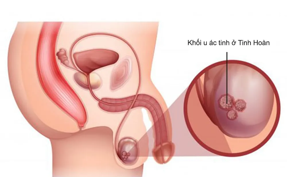 Cấu tạo tinh hoàn: Tìm hiểu kích thước, chức năng và bệnh lý