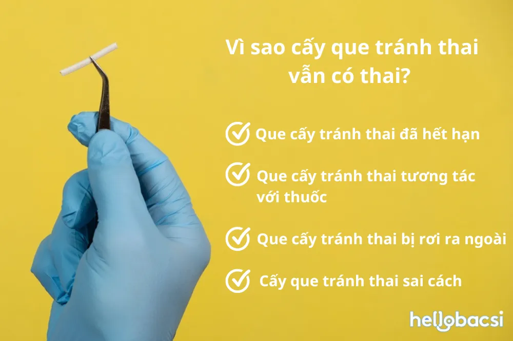 Cấy que tránh thai vẫn có thai có nguy hiểm không? Nguyên nhân và cách xử lý