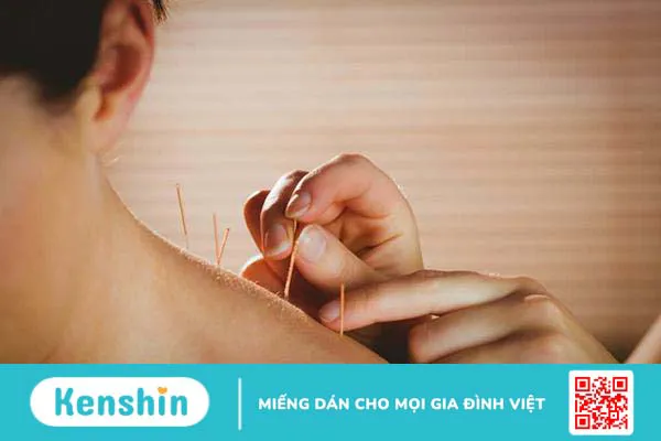 Châm cứu có tác dụng gì? Có nên châm cứu tại nhà?