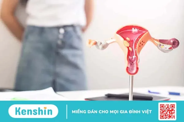 Chậm kinh đau bụng lâm râm – Khi nào là bất thường và nên đi khám?