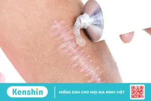 Chăm sóc vết sẹo sinh mổ đúng cách