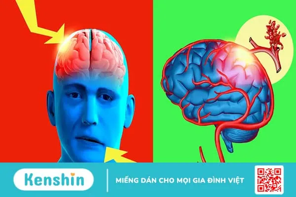 Chẩn đoán thiếu máu não: Cần thực hiện những xét nghiệm gì?