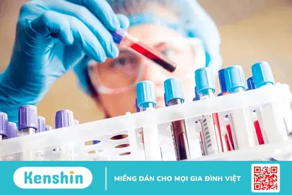 Chẩn đoán tiểu đường tuýp 2: Xét nghiệm và các chỉ số quan trọng