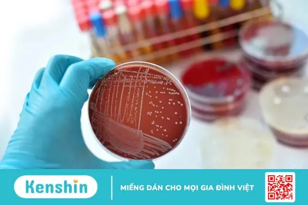 Chẩn đoán và xét nghiệm bệnh lậu