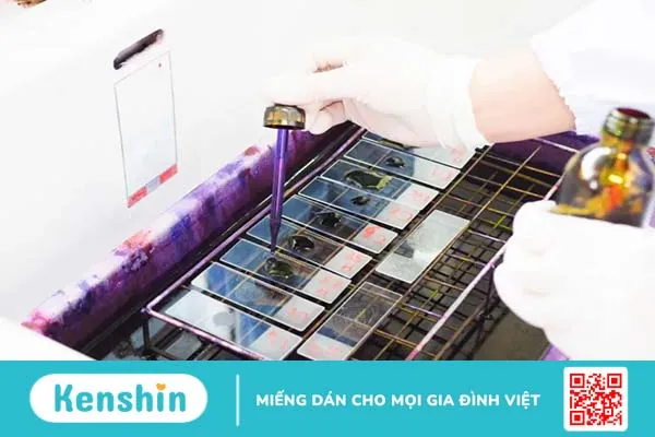 Chẩn đoán và xét nghiệm bệnh lậu