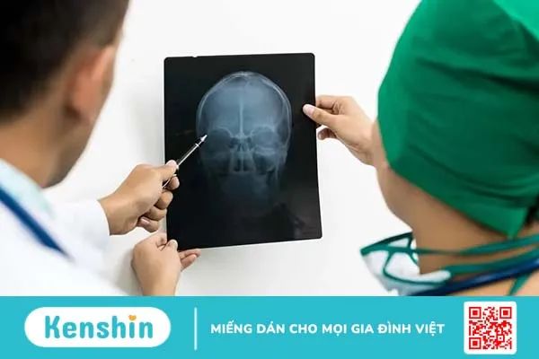 Chảy máu mắt: Tất tần tật thông tin bạn cần biết