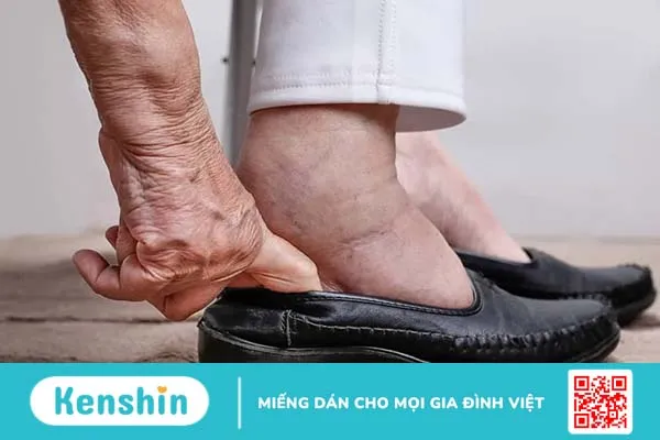 Chế độ dinh dưỡng cho người chạy thận: 4 thành phần cần kiểm soát chặt chẽ