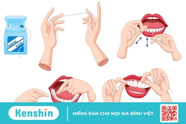 Chỉ nha khoa: Cách dùng đúng chuẩn và 4 “Không” bạn cần lưu ý