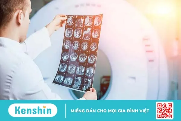 Chi phí 1 lần xạ trị bao nhiêu tiền?