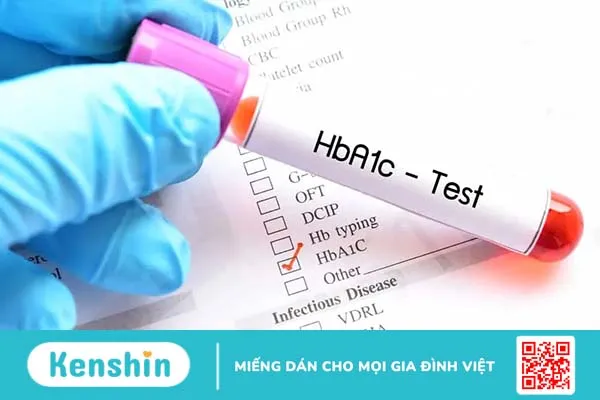 Chỉ số đường huyết của người bị tiểu đường tốt nhất là bao nhiêu?