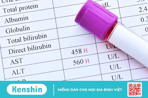 Chỉ số men gan cao và bình thường là bao nhiêu? Nếu cao có đáng lo?