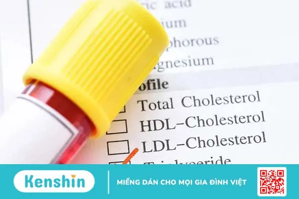 Chỉ số mỡ máu và những điều bạn cần biết