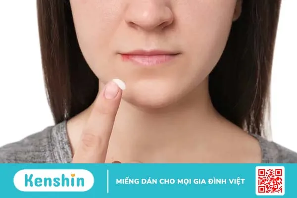 Chốc mép là gì? Nguyên nhân, triệu chứng và cách trị lở mép miệng