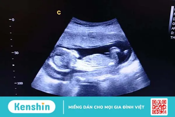 Chu vi vòng bụng thai nhi: Chỉ số tương quan chặt chẽ với trọng lượng thai nhi