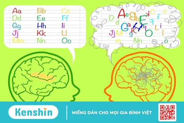 Chứng khó đọc ở trẻ em: Nguyên nhân do đâu, khắc phục thế nào?