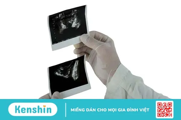 Chụp X-quang bàng quang – niệu đạo