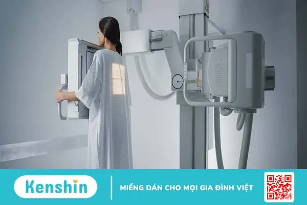 Chụp X quang ung thư phổi và những điều bạn cần biết