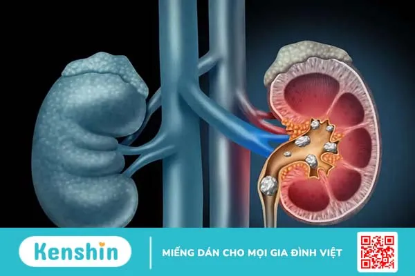 Chuyên gia khuyến cáo: Những người không nên uống tinh bột nghệ