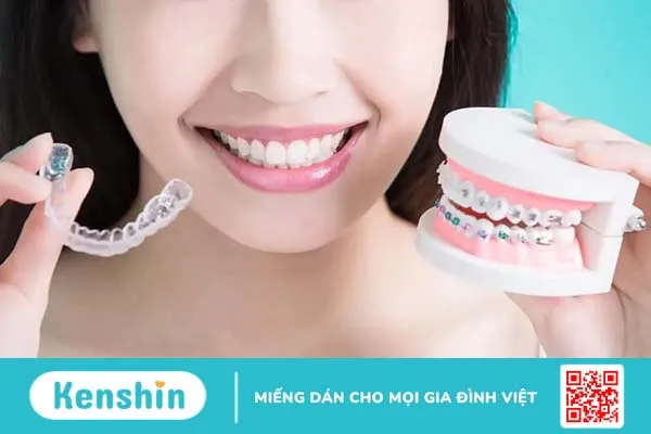 Chuyên gia nha khoa giải đáp: Niềng răng mất bao lâu thì tháo được?