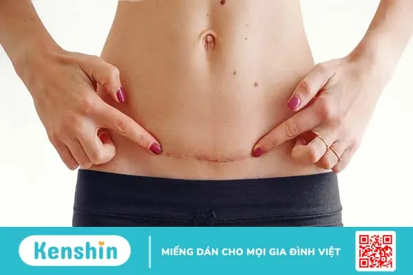 Cơ chế hình thành sẹo và cải thiện thẩm mỹ sau tổn thương