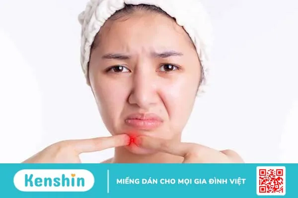 Có nên đi nặn mụn ở spa? Những lưu ý khi nặn mụn