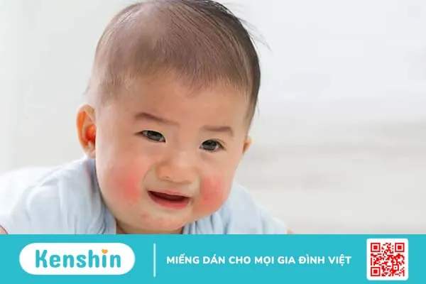 Có nên dùng kem dưỡng ẩm cho trẻ sơ sinh? Top 7 loại kem dưỡng ẩm hằng ngày cho bé có thành phần an toàn với làn da trẻ sơ sinh