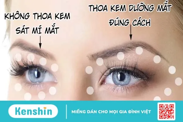 Có nên dùng kem dưỡng mắt không?