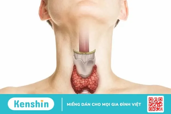 Con gái có ria mép: Nguyên nhân và cách xử lý triệt để