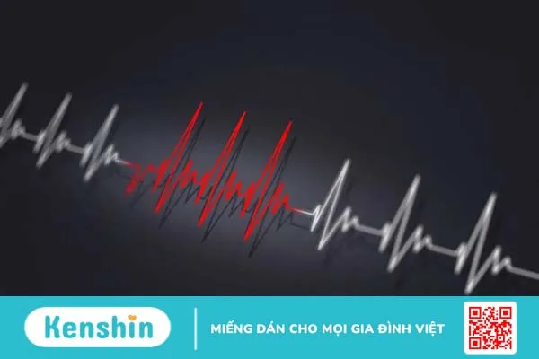 Cơn nhịp nhanh kịch phát trên thất và cách điều trị