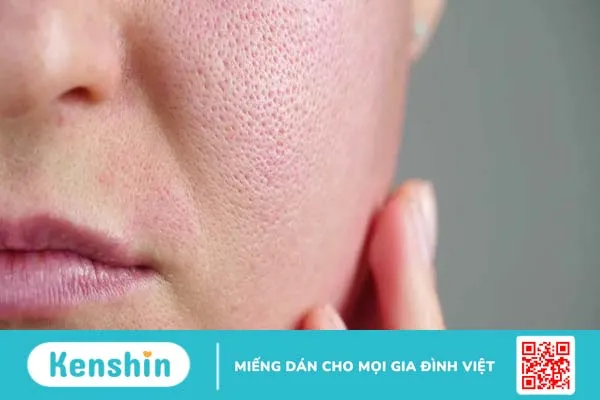 Cồn trong mỹ phẩm tên gì? Có nên sử dụng cho làn da?