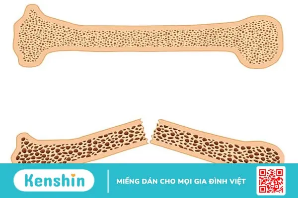 Công dụng của cây kế sữa: Có thể bạn chưa biết