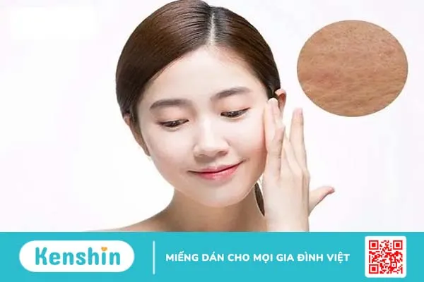 Công nghệ Laser CO2 Fractional trị sẹo có thực sự hiệu quả?