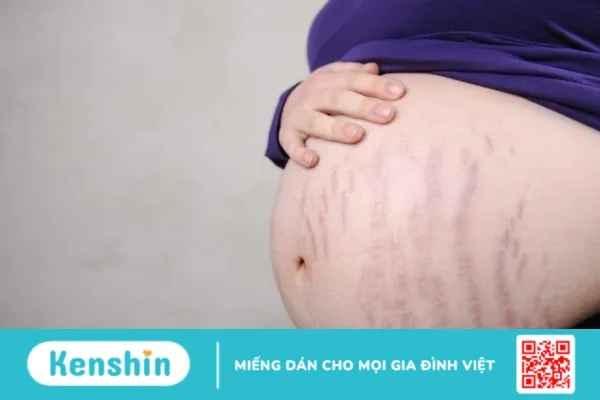 Công thức lấy lại vóc dáng sau sinh cực kỳ đơn giản