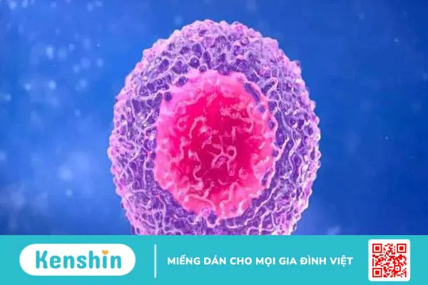 Cúm gây đau đầu nhức mỏi: Nguyên nhân và biện pháp