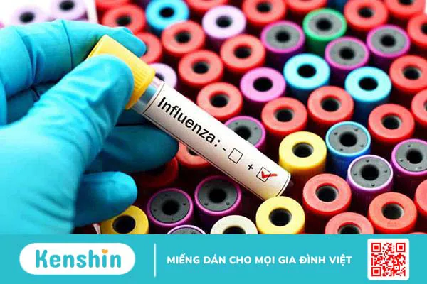 Cúm H3N8: Chủng virus cúm gia cầm mới liệu có đáng lo?