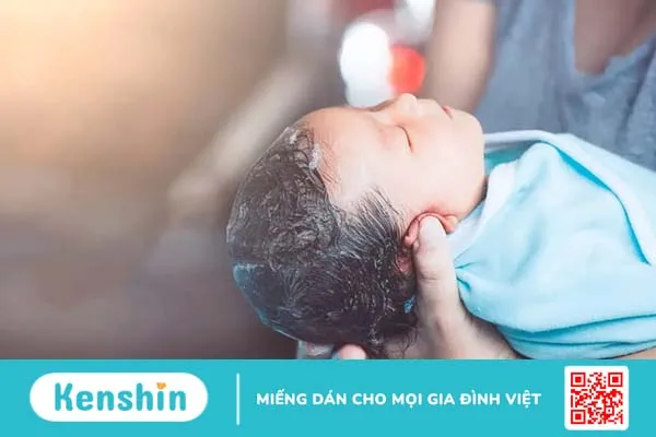 Cứt trâu ở đầu trẻ sơ sinh (viêm da tiết bã): Tất tần tật những điều cần biết