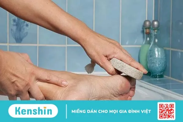 Da chân bị khô, bong tróc là bệnh gì và cách chữa tại nhà